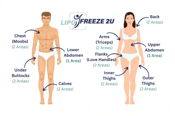 Areas you can have fat freezing treatment Herefordshire