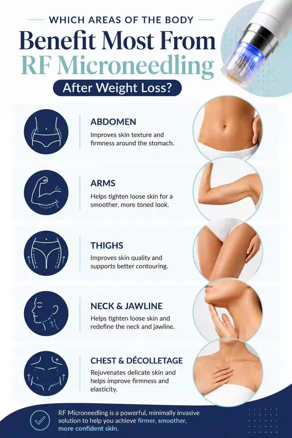 Which Areas of the Body Benefit Most From RF Microneedling After Weight Loss Herefordshire